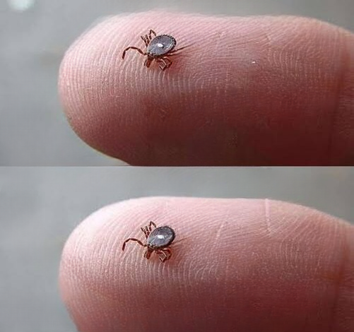 How to Handle a Tick Encounter Safely: Lessons in Awareness and Prevention