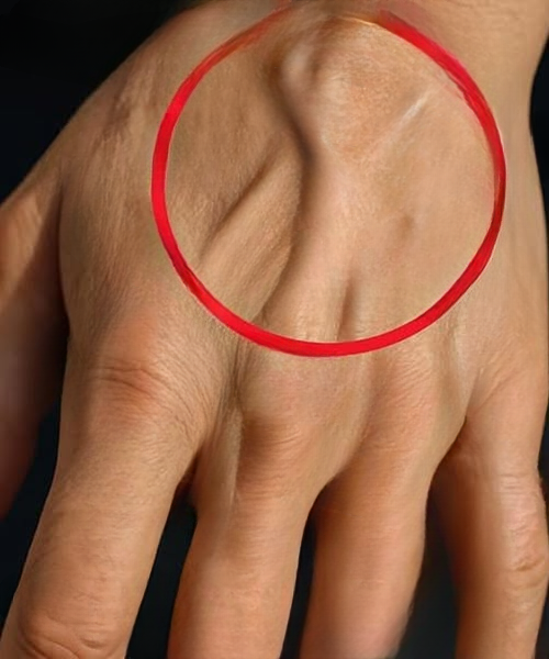 What Visible Hand Veins Can (and Cannot) Tell You About Your Health