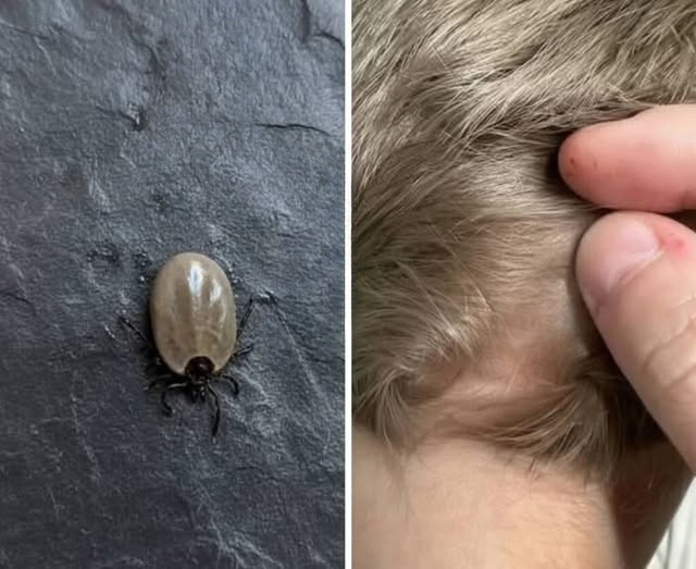 A Tiny Surprise in Your Child’s Hair: A Calm and Practical Guide for Parents When You Discover a Bug