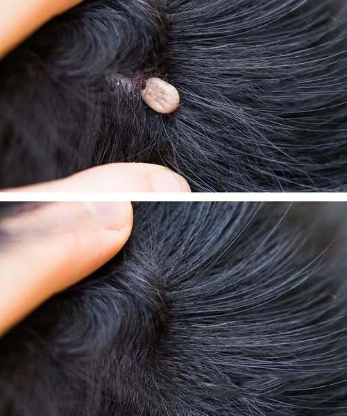 A Parent’s Concern: Noticing Something Unusual in a Child’s Hair