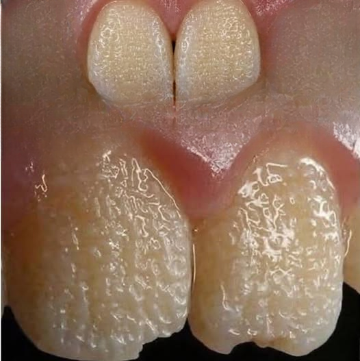 Protecting Your Smile: Understanding How Everyday Foods, Habits, and Genetics Influence Dental Health