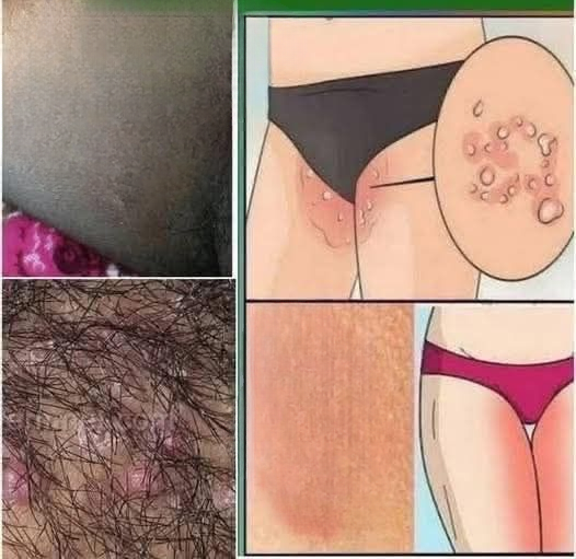 Early Warning Signs Your Skin May Be Sending: A Detailed Guide to Understanding Subtle Body Signals