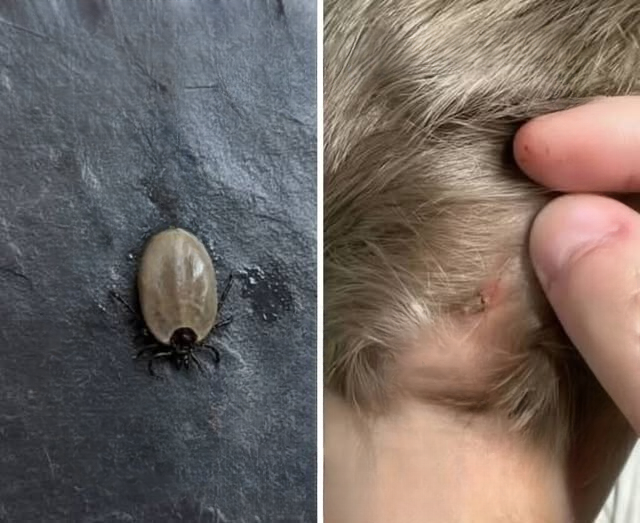The Tiny Scalp Surprise: A Parent’s Complete Guide to Handling Bugs in a Child’s Hair Calmly and Confidently