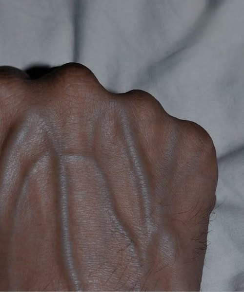 Why Do My Veins Look So Visible? A Detailed Guide to Understanding Prominent Veins in Hands and Body