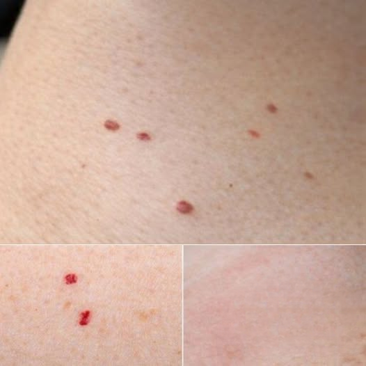 Red Dots on the Skin: Causes, Implications, and Safe Management