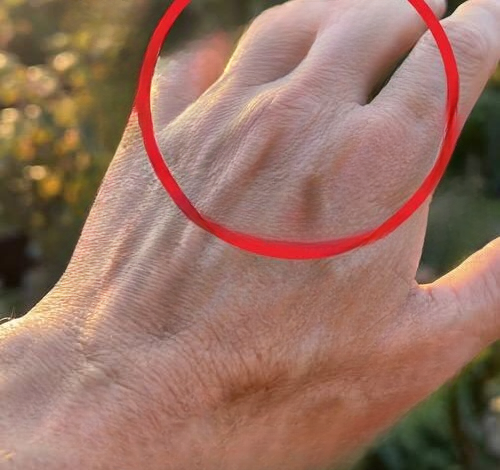 What Changes in Your Hand Veins Could Reveal About Your Overall Health