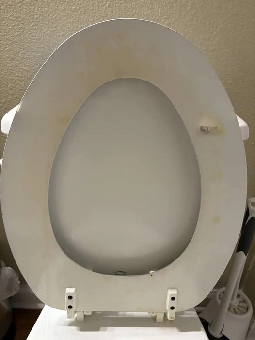 How I Finally Got Rid of Stubborn Yellow Toilet Stains (Simple, Safe, and Effective Cleaning Methods That Actually Work)