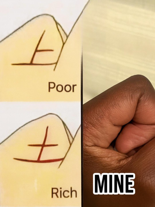 The “Hidden Sign” on Your Hand That People Say Reveals Wealth or Financial Struggles