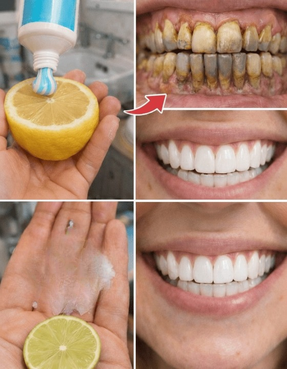 A Gentle Approach to At-Home Teeth Brightening Using Everyday Kitchen Ingredients