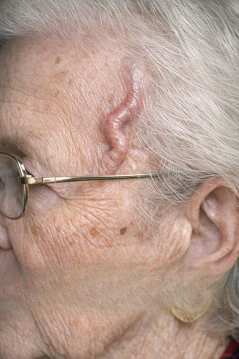 When Severe Head Pain and Jaw Discomfort May Signal Something Serious: What You Need to Know