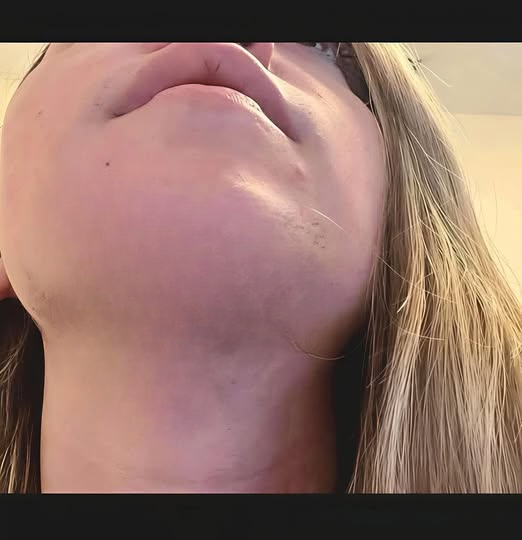Understanding Facial Hair Growth in Women: Causes, Management Strategies, and Lifestyle Approaches