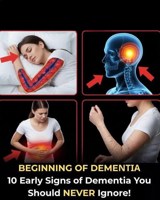 10 Early Signs of Dementia You Should Pay Close Attention To