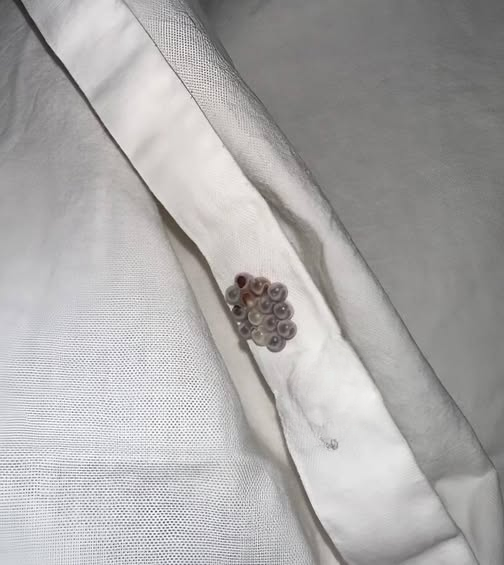 Tiny Balls on Your Bed? Here’s What They’re Likely to Be (And Why There’s No Need to Panic)