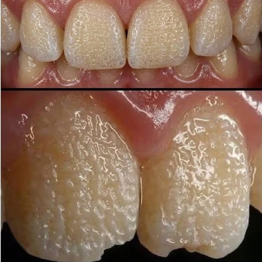 What Your Teeth Are Trying to Tell You: Everyday Habits, Hidden Risks, and a Lesser-Known Genetic Condition