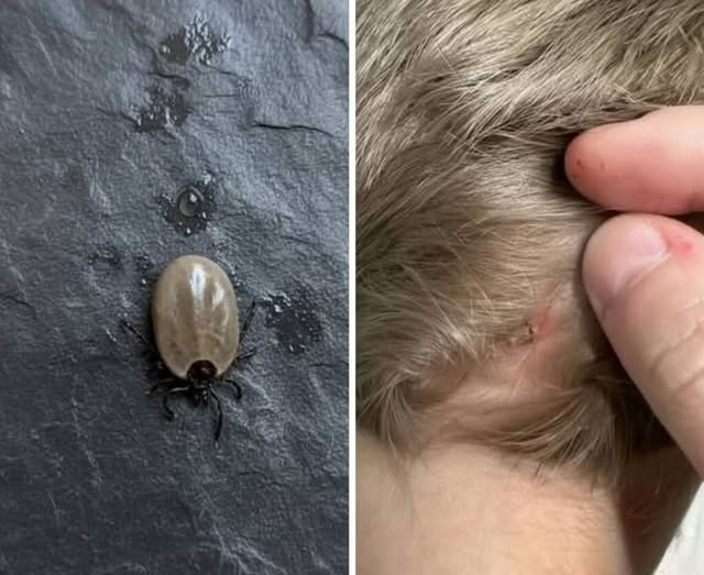 The Small Scalp Surprise: A Calm and Practical Guide for Parents When You Notice an Unusual Bug in Your Child’s Hair