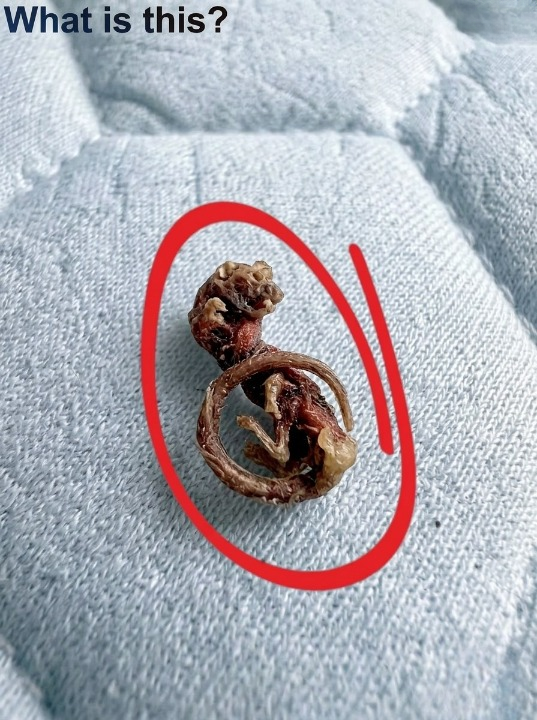 I Woke Up Feeling a Strange Sensation on My Back—What It Could Mean and When to Pay Attention