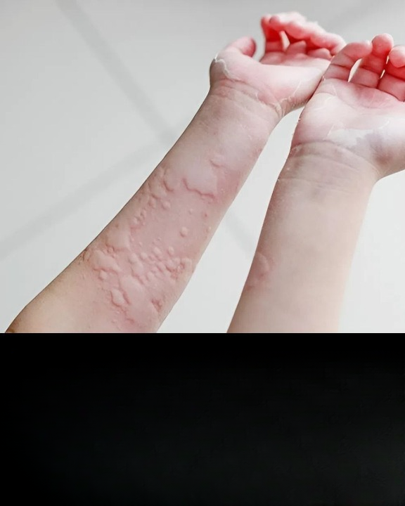 When Skin Reactions Signal Something More Serious: What You Should Never Ignore