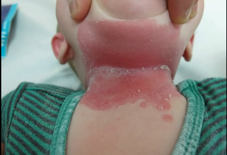 What Your Feet Can Tell You About Your Health: Signs You Shouldn’t Ignore