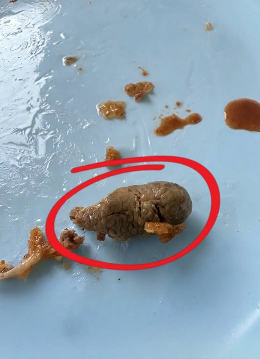 I Found Something Strange in My Fried Chicken — Can Anyone Help Identify It?