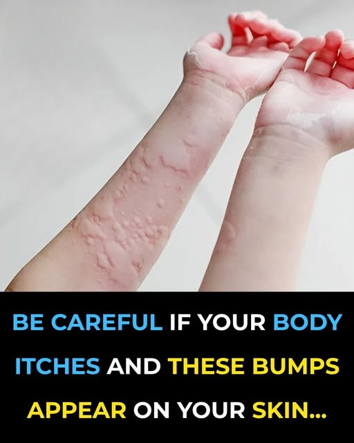 When a Rash Is More Than Just a Rash — Recognizing Serious Allergic Reactions Early