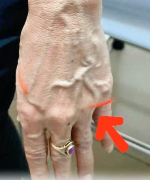 What Visible Veins Really Mean — Understanding Your Body Without Jumping to Conclusions