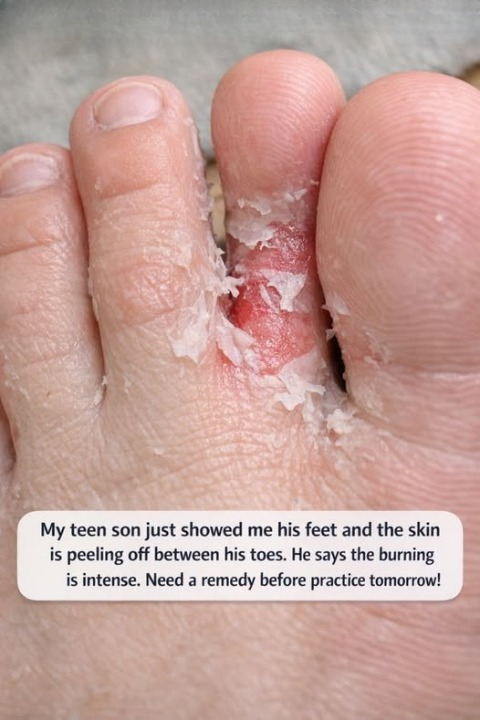 A Parent’s Guide to Helping a Teen Athlete Manage Sudden Foot Irritation Before an Important Practice