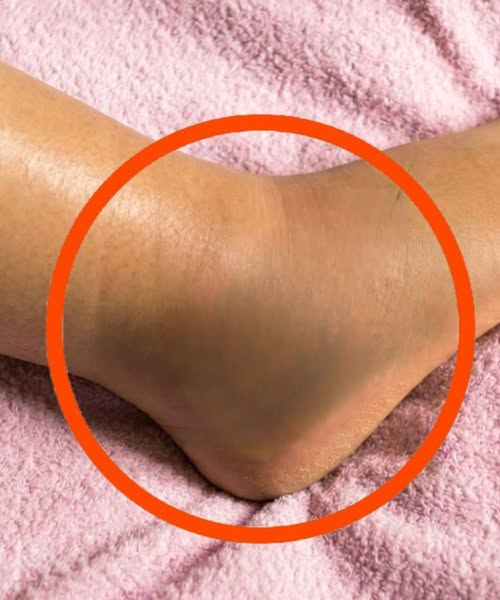 What Swollen Legs Could Be Telling You: Common Causes and Simple Ways to Support Your Well-Being