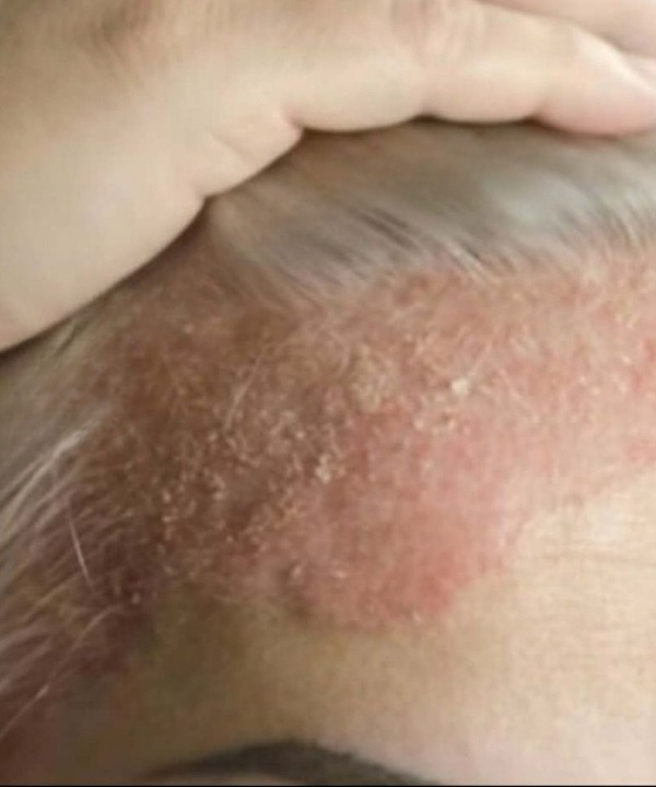 The Everyday Hair Care Habit That Could Be Making Your Scalp Problems Worse