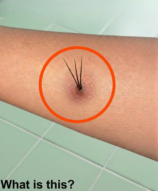 What I Thought Was Growing Out of My Skin After a Hike Turned Out to Be Something Much Less Frightening