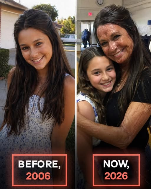 Daughter Begs Her Scarred Mother Not to Attend School — Then a Surprise Revelation Changes the Entire Room