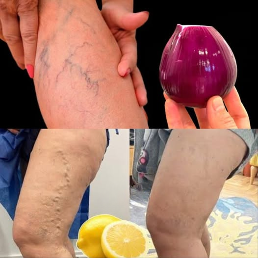 Simple Natural Ways to Support Comfort in Legs and Joints