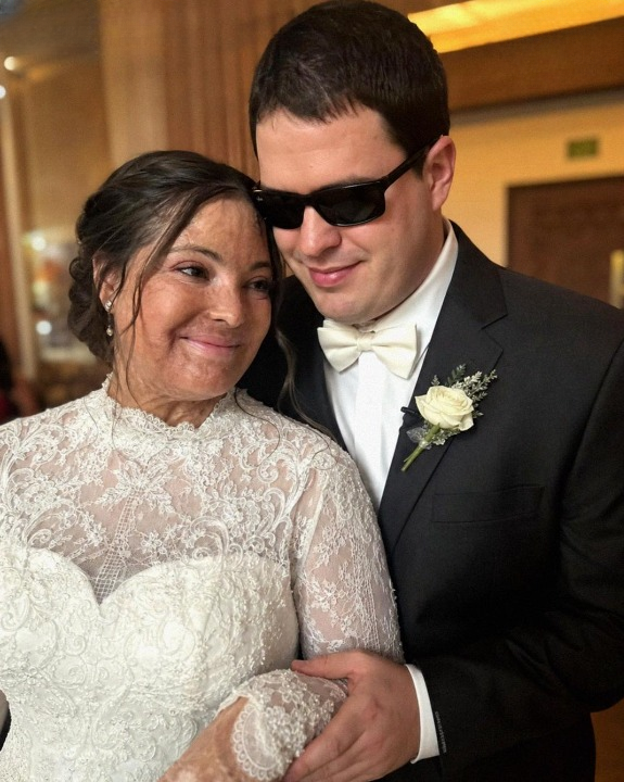 I Married a Blind Man Because I Thought He’d Never See My Scars — But on Our Wedding Night, He Revealed a Secret That Changed Everything I Believed About My Past