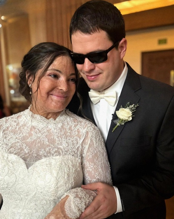 She Spent Years Hiding Her Scars From the World — Then Her New Husband Revealed a Secret That Changed Everything
