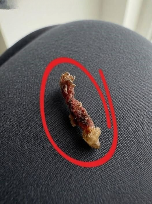 I Kept Feeling Something Crawling on My Skin at Night — The Real Explanation Surprised Me