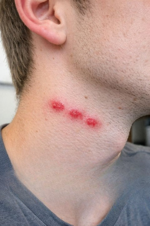 We Woke Up to Find Several Red Marks in a Straight Line on My Brother’s Neck — Here’s What We Learned About Identifying Unexplained Skin Irritations