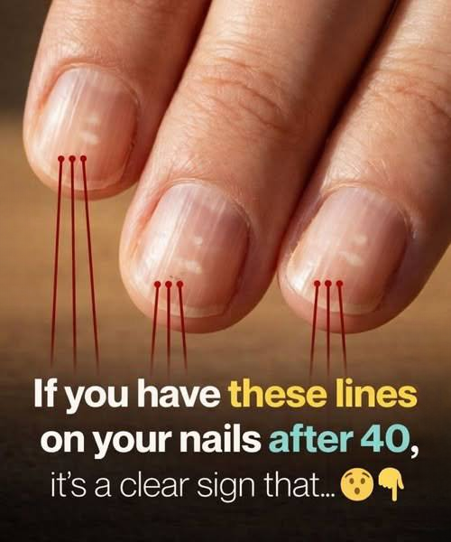 What Your Fingernails Can Sometimes Reveal About Your Health—And Why Medical Professionals Pay Attention to Them