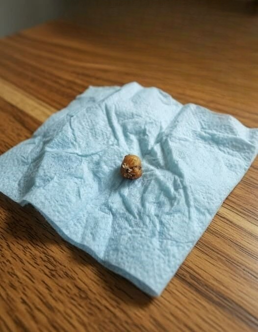 Something Small Fell Out While My Girlfriend Was Washing Her Hair — We Spent Hours Trying to Figure Out What It Was