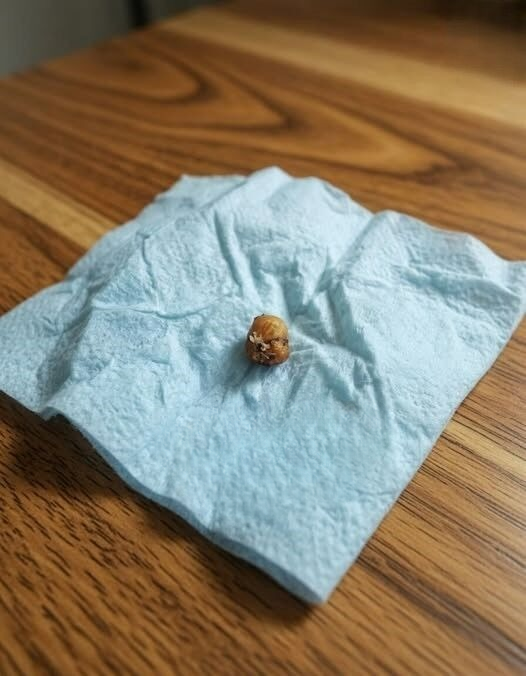 A Strange 1 cm Object Fell Out While My Girlfriend Was Washing Her Hair — We Were Completely Stumped Until We Learned What It Might Be