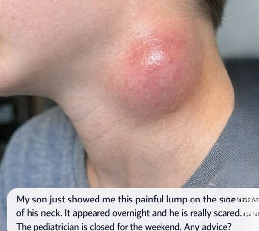 Parents Were Alarmed After Discovering a Sudden Lump on Their Child’s Neck — Here’s What Health Experts Say You Should Know