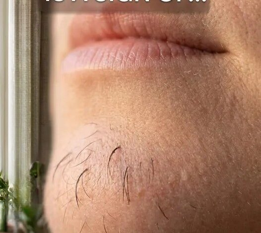 Understanding Unexpected Chin Hair Growth in Women: What Your Body May Be Trying to Tell You