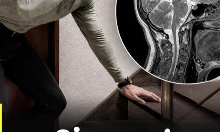 Understanding Aneurysms: Symptoms, Risk Factors, and the Importance of Early Medical Attention