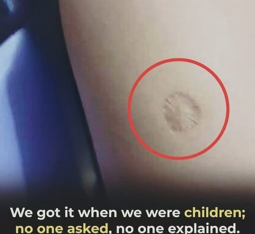 The Small Round Scar Many People Carry: A Reminder of One of Public Health’s Greatest Achievements